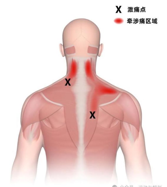 触发点的形成与缓解策略