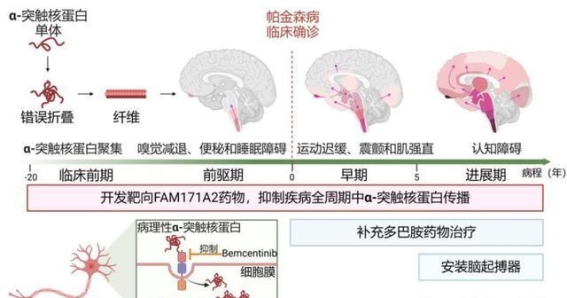 帕金森病治疗新靶点的发现与前景