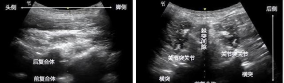 300斤孕妇危急时刻的生死救援：西安市人民医院的紧急手术