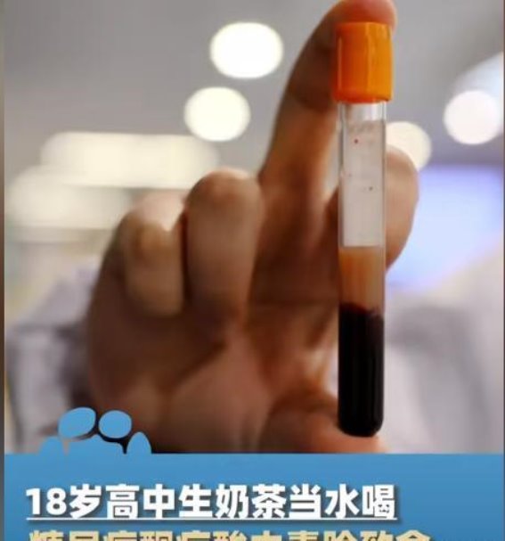 18岁男孩患糖尿病，背后竟是无节制的饮食，家长心痛不已